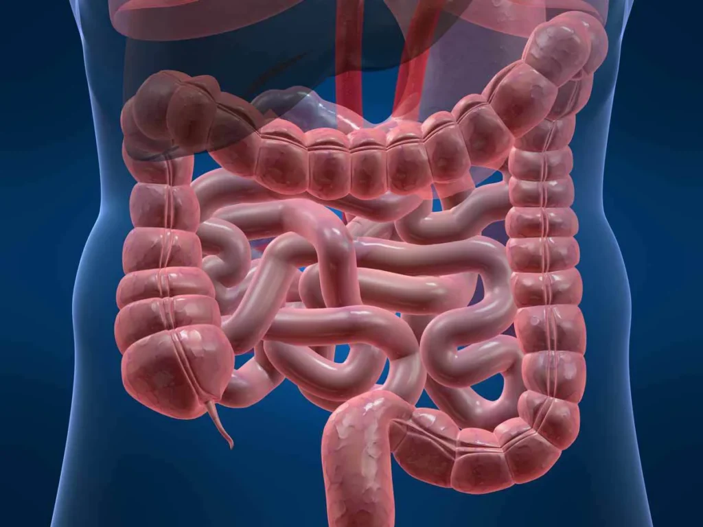 How the Mediterranean Diet Helped Heal Crohn’s Disease: A Case Study